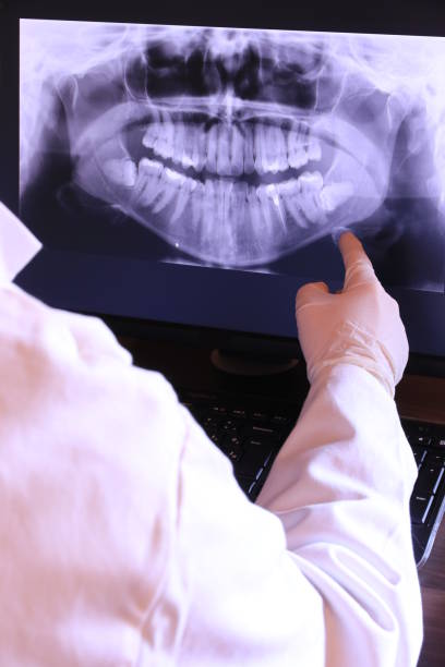 Best Emergency Wisdom Tooth Extraction in Essex, IL