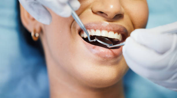 Best Emergency Dental Care for Sports Injuries in Essex, IL